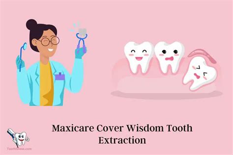 Does Maxicare Cover Wisdom Tooth Extraction: Yes! .